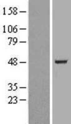 Western Blot: ACTL6B Overexpression Lysate [NBL1-07278]