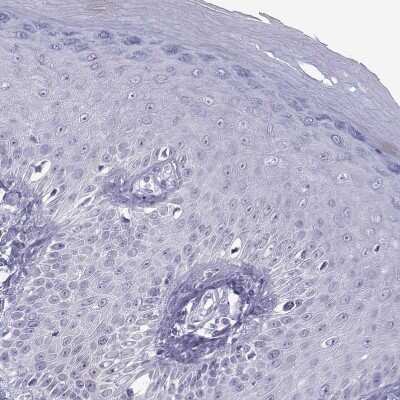 Immunohistochemistry-Paraffin: ACTL7A Antibody [NBP1-86014]