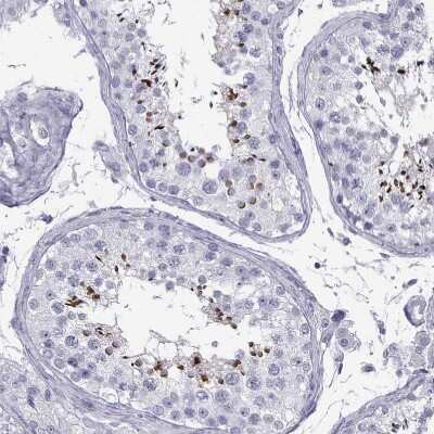 Immunohistochemistry-Paraffin: ACTL7A Antibody [NBP1-86014]