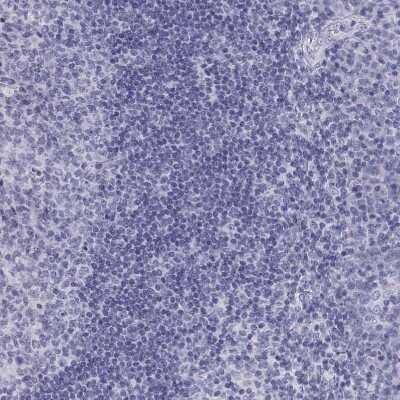 Immunohistochemistry-Paraffin: ACTL7A Antibody [NBP1-86014]