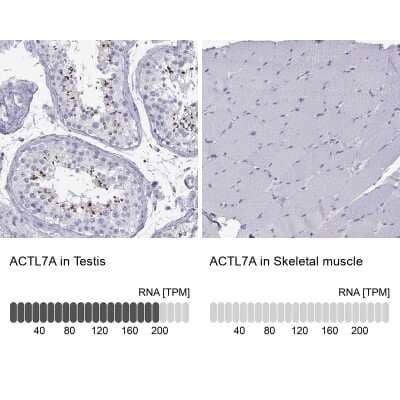 Immunohistochemistry-Paraffin: ACTL7A Antibody [NBP1-86014]