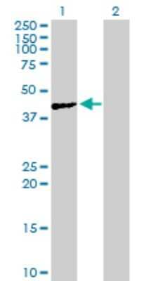 Western Blot: ACTL7A Antibody [H00010881-B01P]