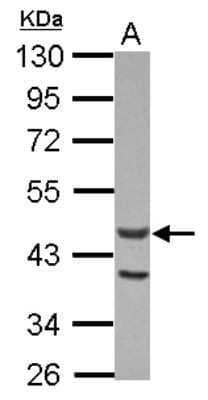 Western Blot: ACTL7A Antibody [NBP2-15270]