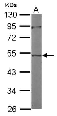 Western Blot: ACTL7A Antibody [NBP2-15271]