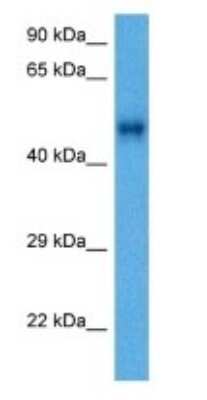 Western Blot: ACTL7A Antibody [NBP3-10804]