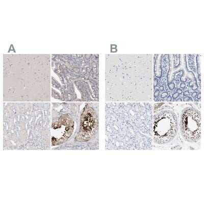 Immunohistochemistry-Paraffin: ACTL7B Antibody [NBP1-86972]