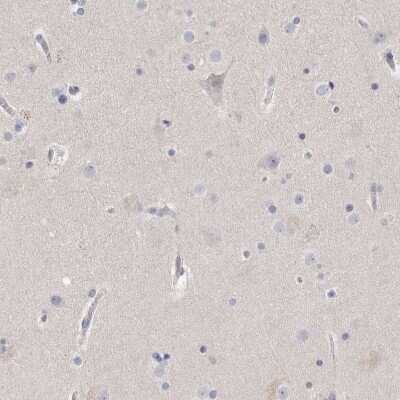 Immunohistochemistry-Paraffin: ACTL7B Antibody [NBP1-86972]