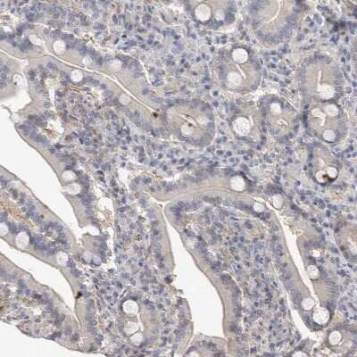 Immunohistochemistry-Paraffin: ACTL7B Antibody [NBP1-86972]