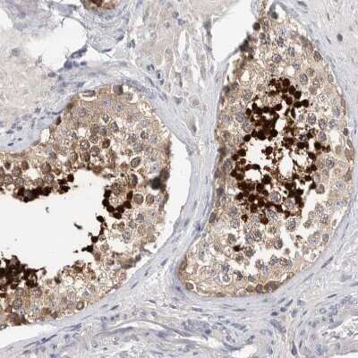 Immunohistochemistry-Paraffin: ACTL7B Antibody [NBP1-86972]