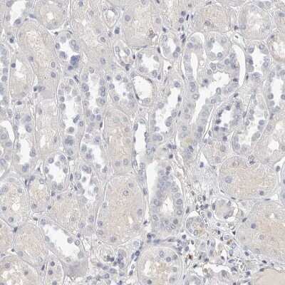 Immunohistochemistry-Paraffin: ACTL7B Antibody [NBP1-86972]