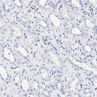 Immunohistochemistry-Paraffin: ACTL7B Antibody [NBP1-86973]