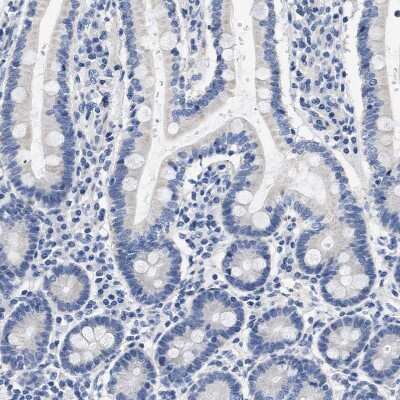 Immunohistochemistry-Paraffin: ACTL7B Antibody [NBP1-86973]