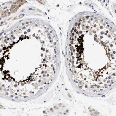 Immunohistochemistry-Paraffin: ACTL7B Antibody [NBP1-86973]