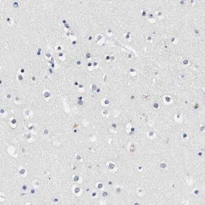 Immunohistochemistry-Paraffin: ACTL7B Antibody [NBP1-86973]