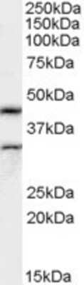 Western Blot: ACTL7B Antibody [NB100-57848]