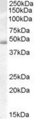 Western Blot: ACTL7B Antibody [NB100-93366]