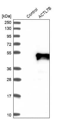 Western Blot: ACTL7B Antibody [NBP1-86972]