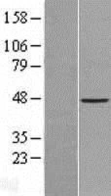 Western Blot: ACTL7B Overexpression Lysate [NBL1-07280]