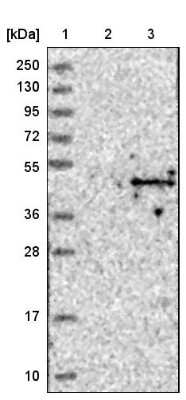 Western Blot: ACTL8 Antibody [NBP1-85398]