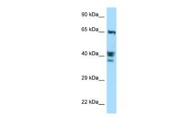 Western Blot: ACTL8 Antibody [NBP2-86952]