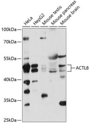 Western Blot: ACTL8 AntibodyAzide and BSA Free [NBP2-92196]