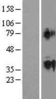 Western Blot: ACTL9 Overexpression Lysate [NBP2-04960]