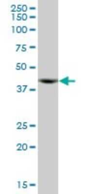 Western Blot: ACTR10 Antibody [H00055860-B01P]