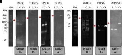 Western Blot: ACTR10 Antibody [H00055860-B01P]