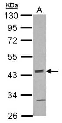 Western Blot: ACTR10 Antibody [NBP2-15273]