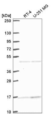 Western Blot: ACTR10 Antibody [NBP2-55963]