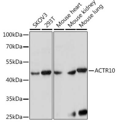 Western Blot: ACTR10 AntibodyAzide and BSA Free [NBP2-92268]