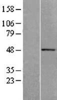 Western Blot: ACTR10 Overexpression Lysate [NBL1-07284]