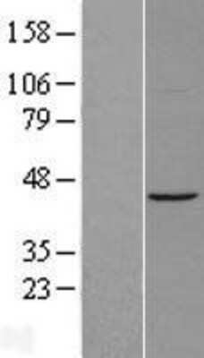 Western Blot: ACTR1A Overexpression Lysate [NBL1-07285]