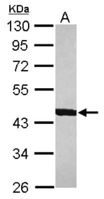 Western Blot: ACTR1B Antibody [NBP2-15275]