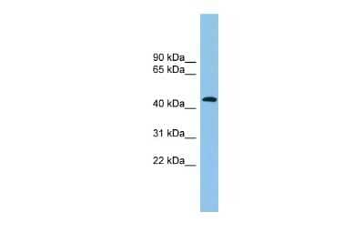 Western Blot: ACTR1B Antibody [NBP2-88761]