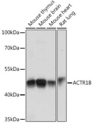 Western Blot: ACTR1B AntibodyAzide and BSA Free [NBP2-92261]