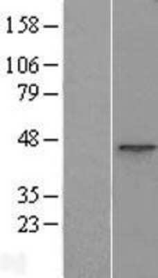 Western Blot: ACTR1B Overexpression Lysate [NBL1-07286]