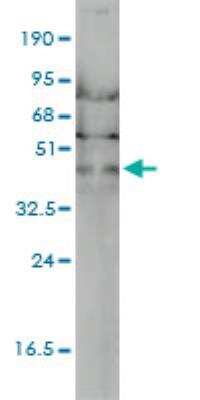 Western Blot: ACTR2 Antibody (1B10-C4) [H00010097-M01]