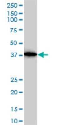 Western Blot: ACTR2 Antibody (1B10-C4) [H00010097-M01]