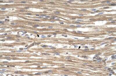 Immunohistochemistry-Paraffin: ACTR2 Antibody [NBP1-53201]