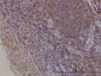 Immunohistochemistry-Paraffin: ACTR3 Antibody (2B6) [H00010096-M02]