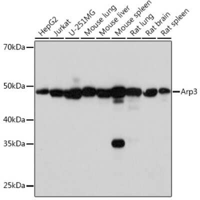 Western Blot: ACTR3 Antibody (8K4F2) [NBP3-16424]