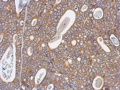 Immunohistochemistry-Paraffin: ACTR3 Antibody [NBP2-15277]
