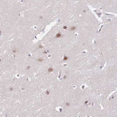 Immunohistochemistry-Paraffin: ACTR3 Antibody [NBP2-33477]