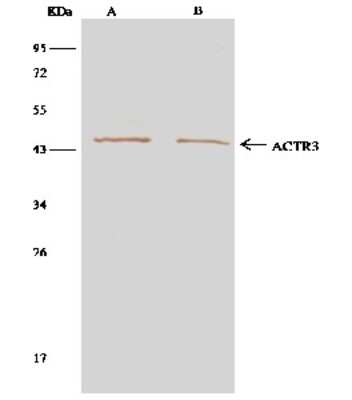 Immunoprecipitation: ACTR3 Antibody [NBP2-97009]