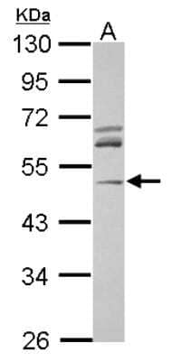 Western Blot: ACTR3 Antibody [NBP2-15277]