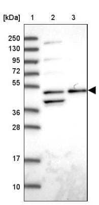 Western Blot: ACTR3 Antibody [NBP2-33477]