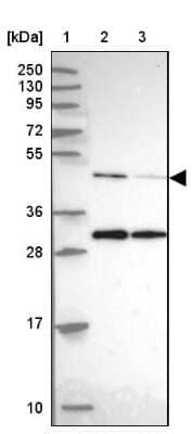 Western Blot: ACTR3 Antibody [NBP2-33623]