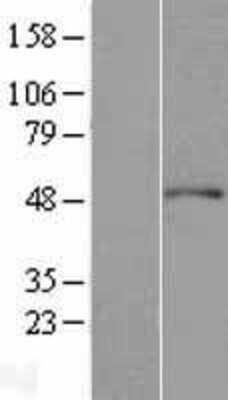 Western Blot: ACTR3 Overexpression Lysate [NBL1-07288]