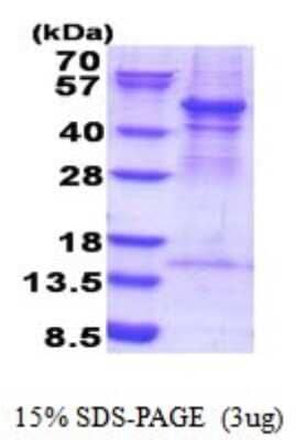 SDS-PAGE: Recombinant Human ACTR3 His Protein [NBP2-51846]